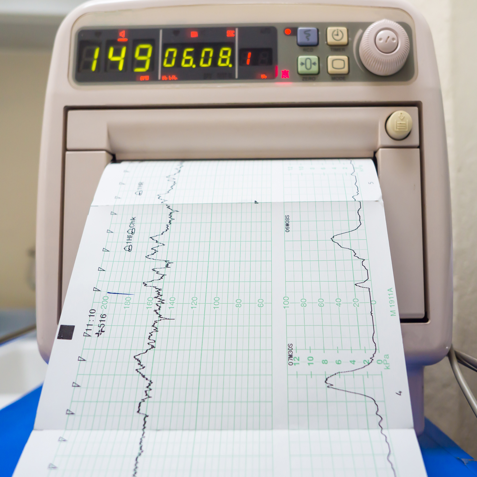 How to Monitor the BCH Stress Test and Get Involved